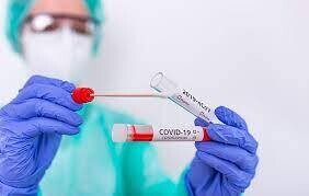 За последние сутки выявлено 248 случаев заражения коронавирусом
